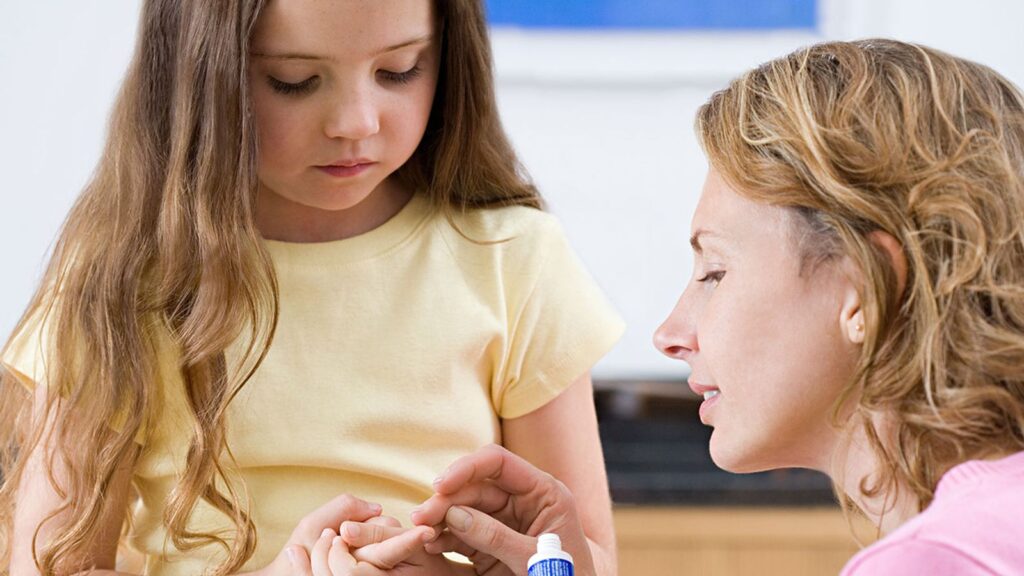 leczenie kurzajek u dzieci